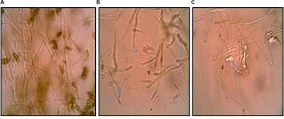 Biocontrol Potential of Streptomyces hydrogenans Strain DH16 toward <mark class="highlighted">Alternaria brassicicola</mark> to Control Damping Off and Black Leaf Spot of Raphanus sativus